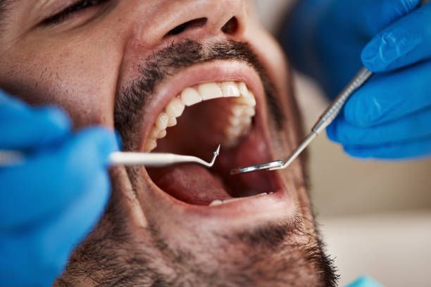 Best Orthodontic Emergency Dentist in Fairburn, GA